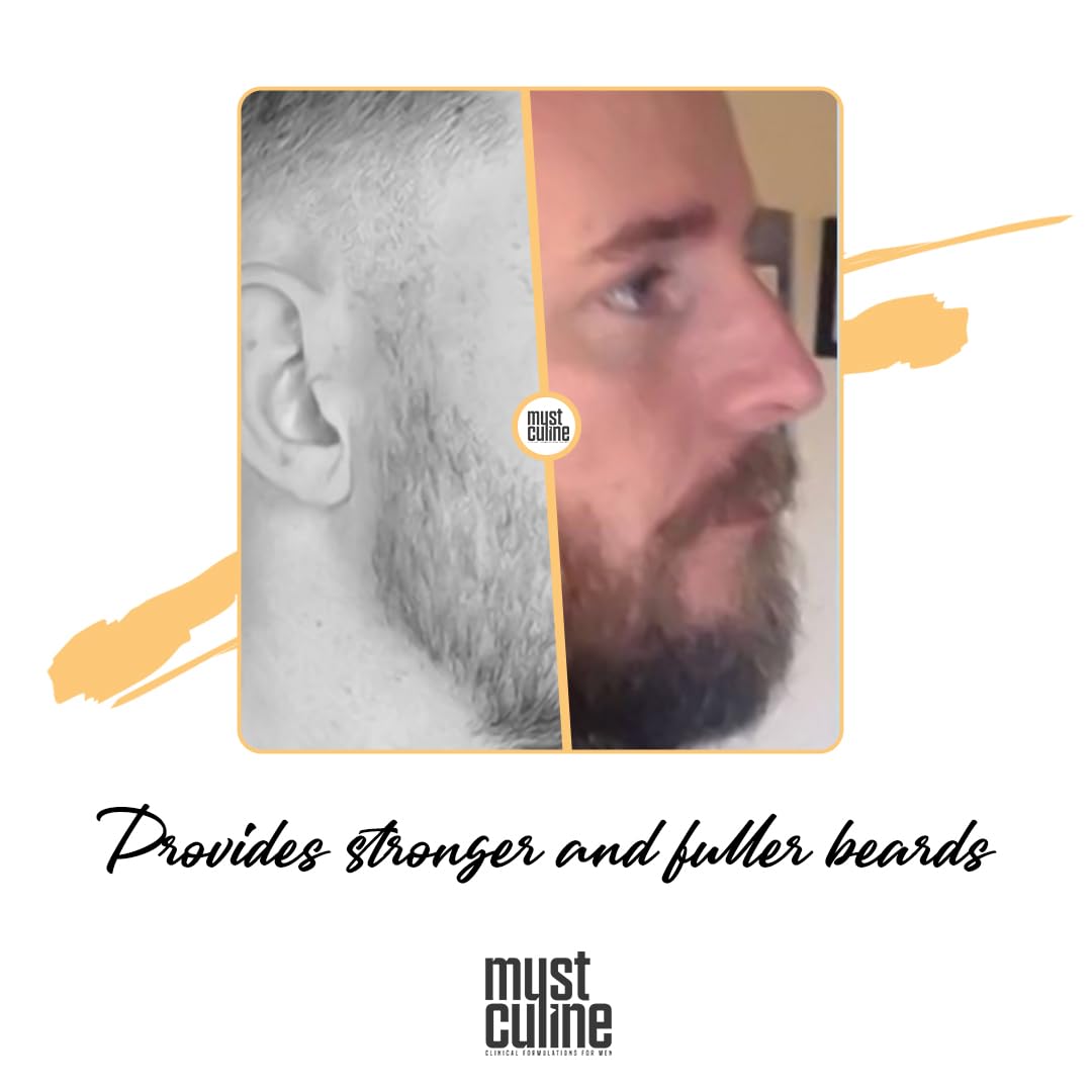 Beard Root Vitamin Spray, 1.7 Fl Oz, Unscented, Supports Growth and Strengthening, Fuller, Thicker, Bushy Beards, Adults, Men's Products