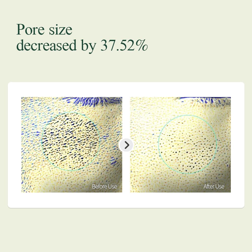 PYUNKANG YUL Calming Line Gift Box Set-Korean Facial Skin Care Essential for Daily Moisturizing with Toner, Serum, Cream, Safe on Acne Prone & Sensitive Skin, Vegan & Cruelty Free