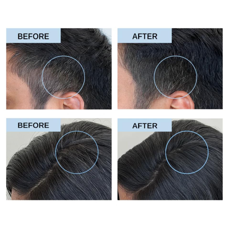 HALFTONE Multi-Peptide Grey Hair Treatment Serum | With Silverfree, Greyverse, Capixyl Peptides | Anti Grey Hair Regrowth, Recover Natural Color Pigment, Scalp Health | Vegan, Scent-Free, Oil-Free