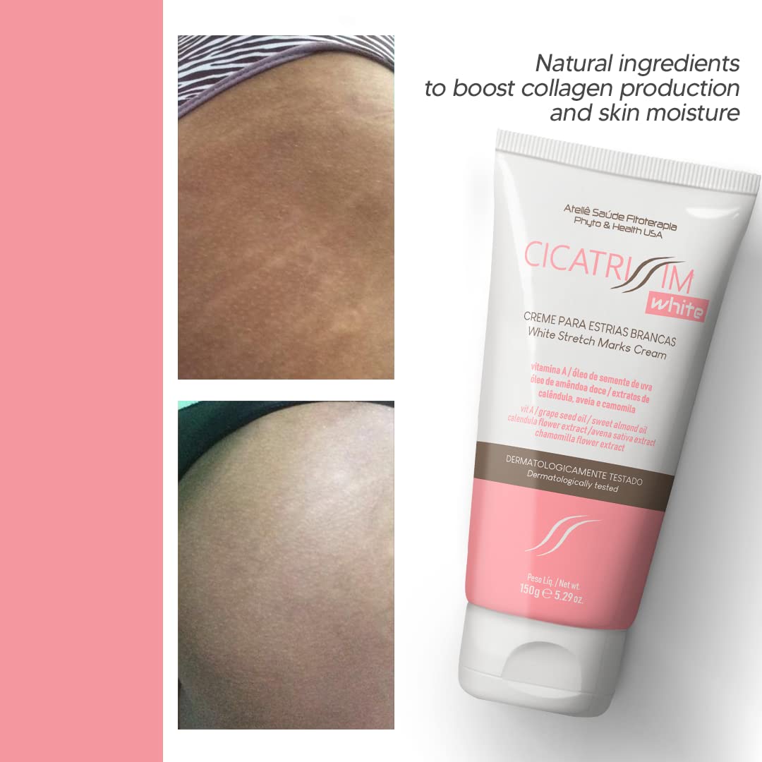 Cicatrissim White Stretch Mark Fade and Removal Cream - Innovative Formula With Pure and Powerful Natural Ingredients From Brazilian Flora - For All Skin Types.
