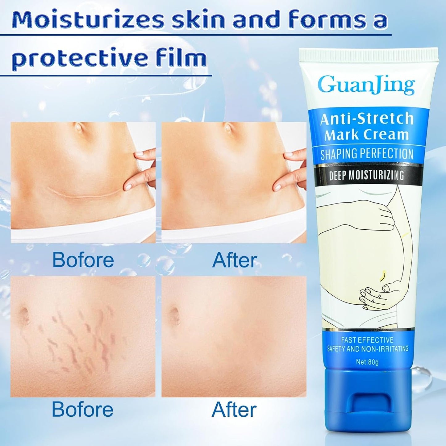 Stretch Mark Removal, Stretch Mark Cream for Pregnancy, Scar Removal Cream Deep Stretch Mark Removal, Belly Butter for Pregnant Women To Prevent And Repair Maternity Stretch Marks Scar 2.82 Oz