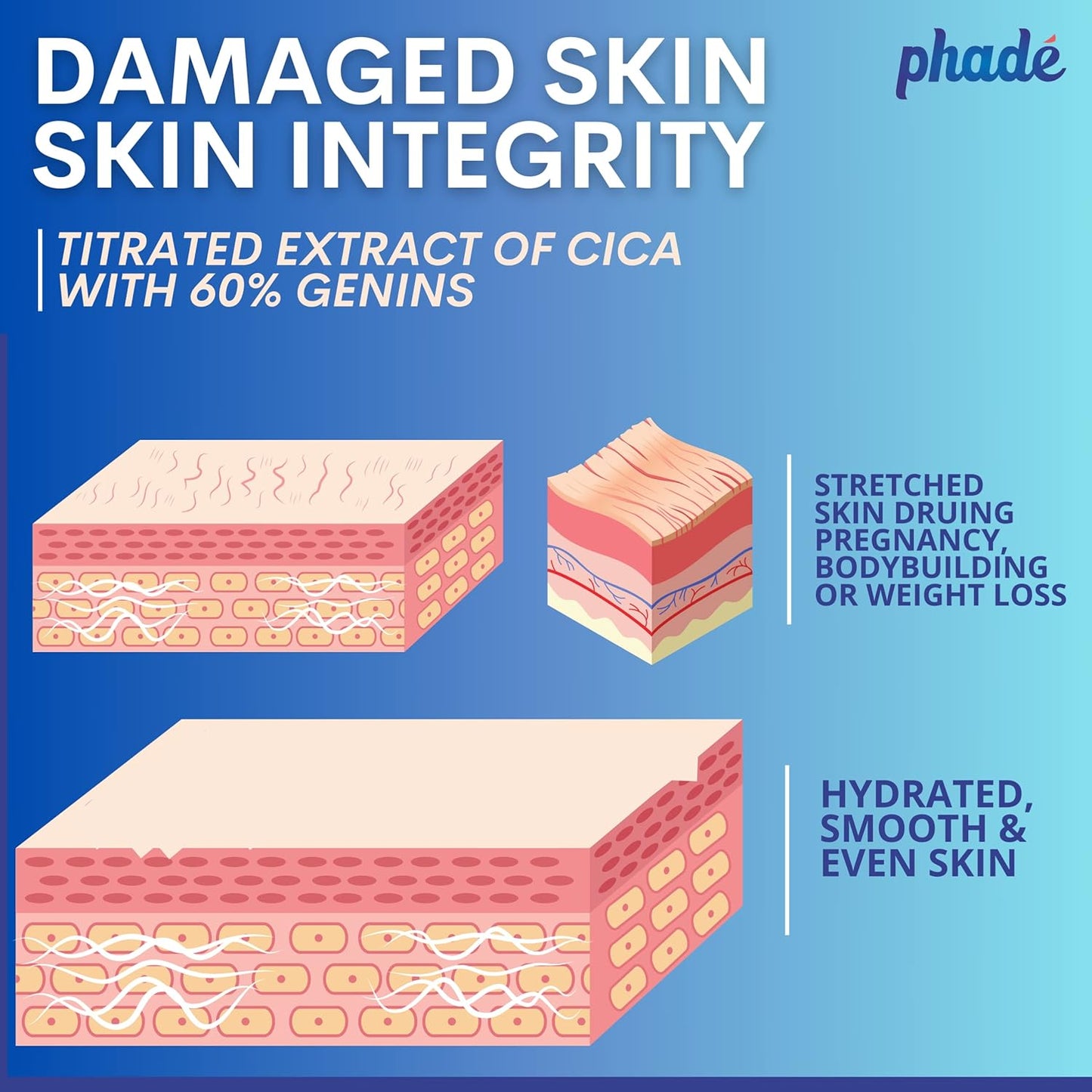 Phade Stretch Mark Cream with CICA - 200ml | Pregnancy, Scars, Uneven Skin Tone, Aging | Dermatologist Tested, Clinically Proven Formula for Stretch Marks, Hydration, and Skin Repair