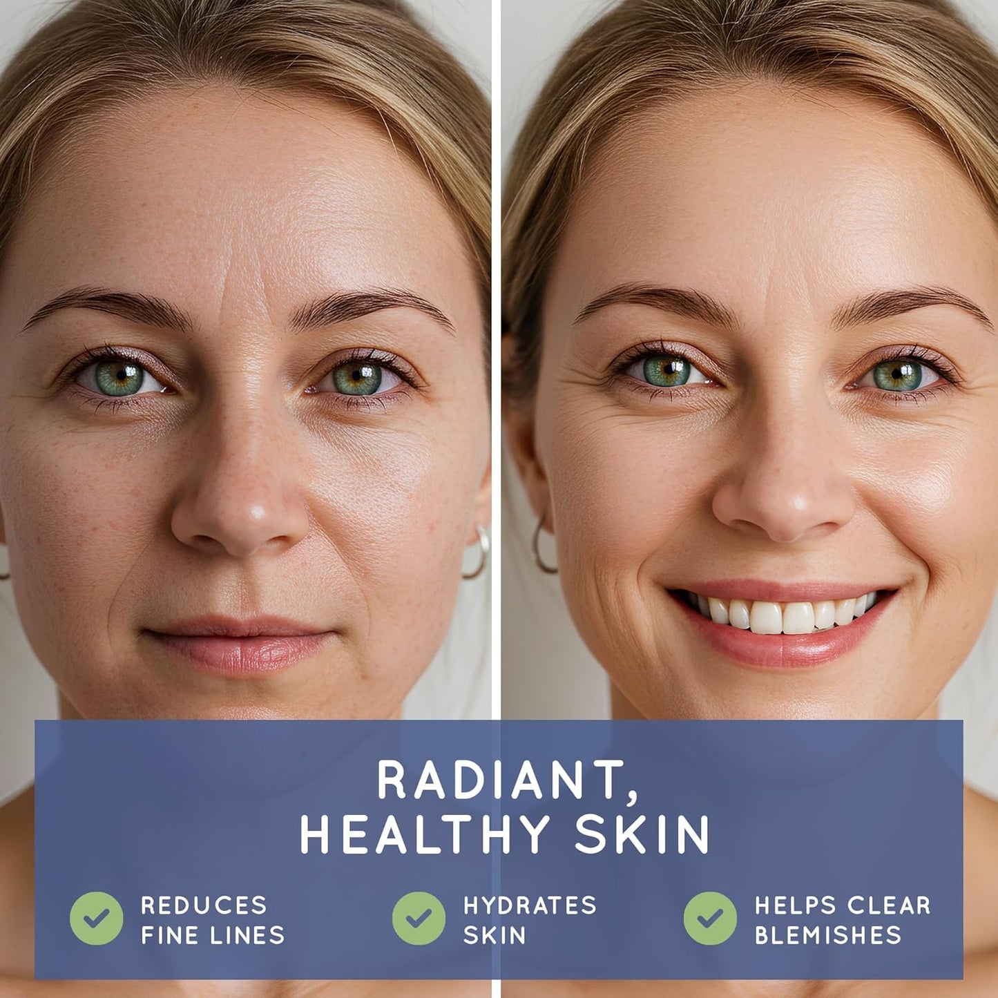 Biotin (Biotina Vitaminas) - Hair Skin Nails Vitamins for Women & Men - 5000 mcg - Hair Growth Support Supplements - 90 Tablets - with Revytalyz 5, Vitamin A, C, B12 - Made in USA