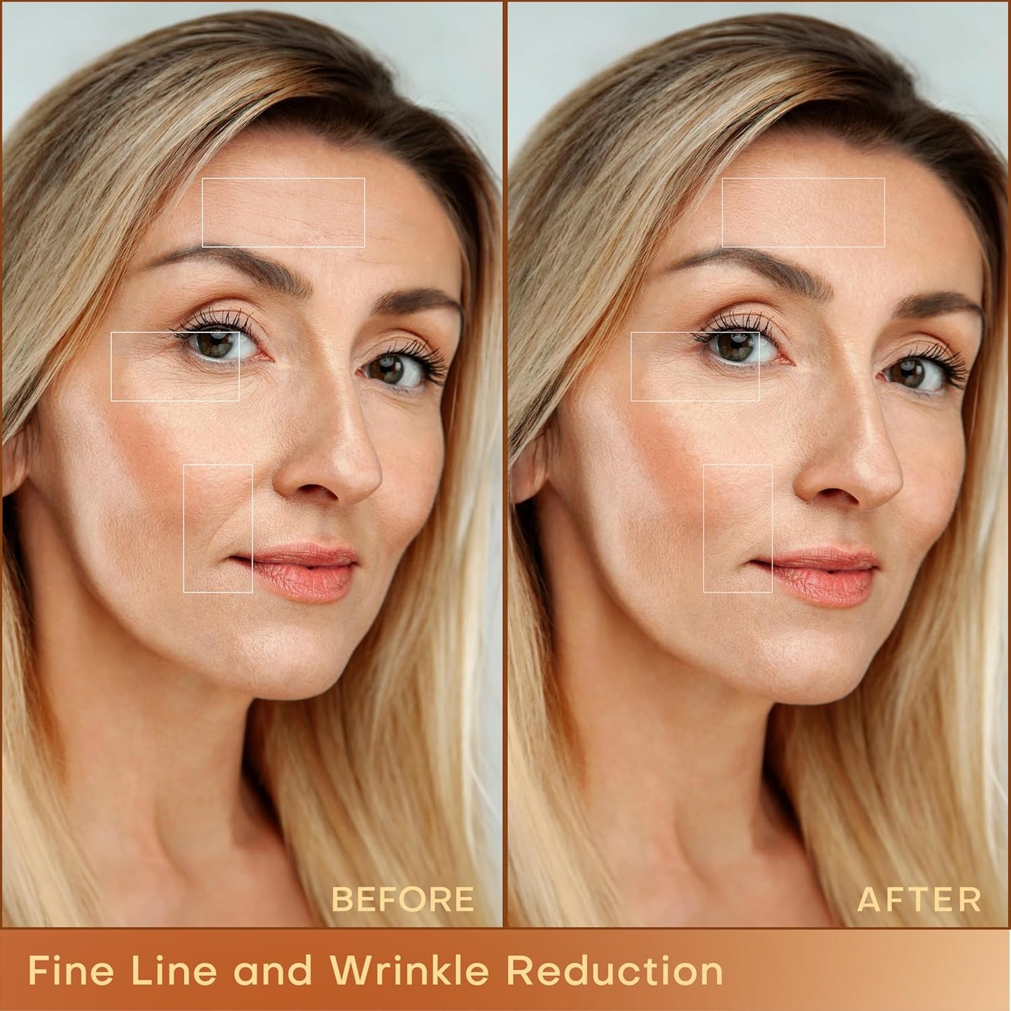 MLAY Professional RF Beauty Machine, Radio Frequency Face Machine with 2 Probes, at Home Radio Frequency Skin Tightening for Lifting, Wrinkle Reducing, Anti Aging - Salon Effects（Gel Included）